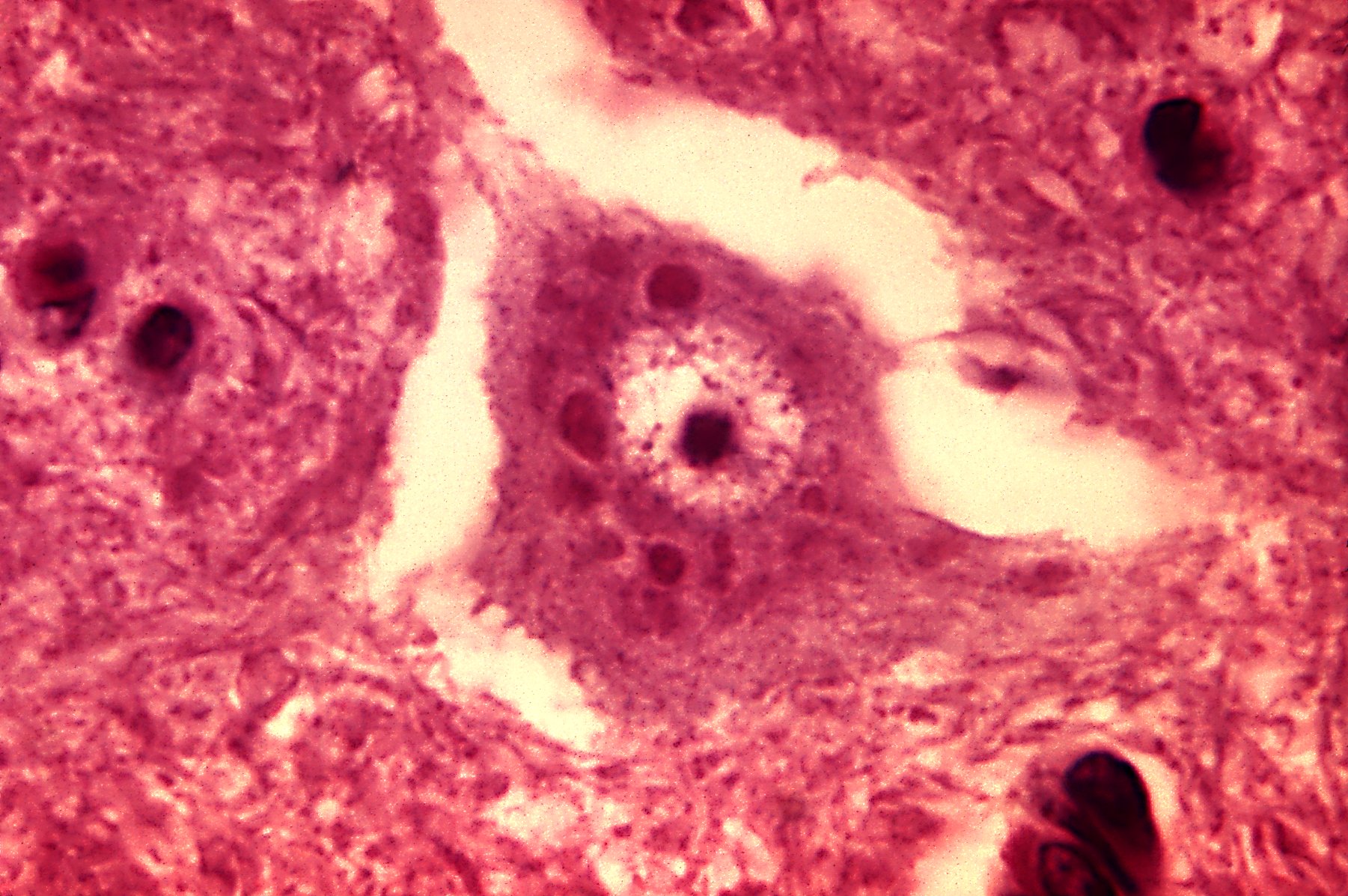 Горещи новини | Пускат от самолет  86 000 ваксини срещу бяс при дивите животни