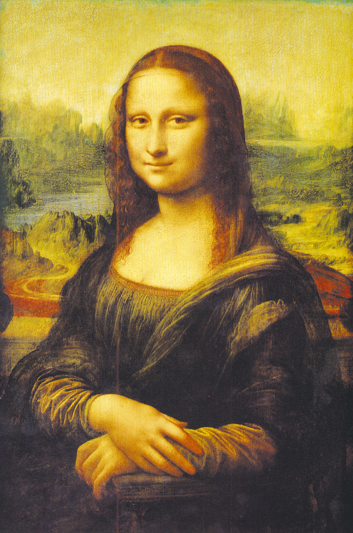 Според световни проучвания прототипът на известната картина на Леонардо да Винчи - Джокондата, е била първият диагностициран пациент с хиперхолестеролемия.