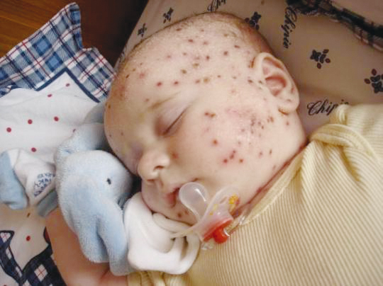 Цветозара Златанова-Тронвил, председател на Европейската асоциация на жените: “В България няма политика към децата с увреждания”