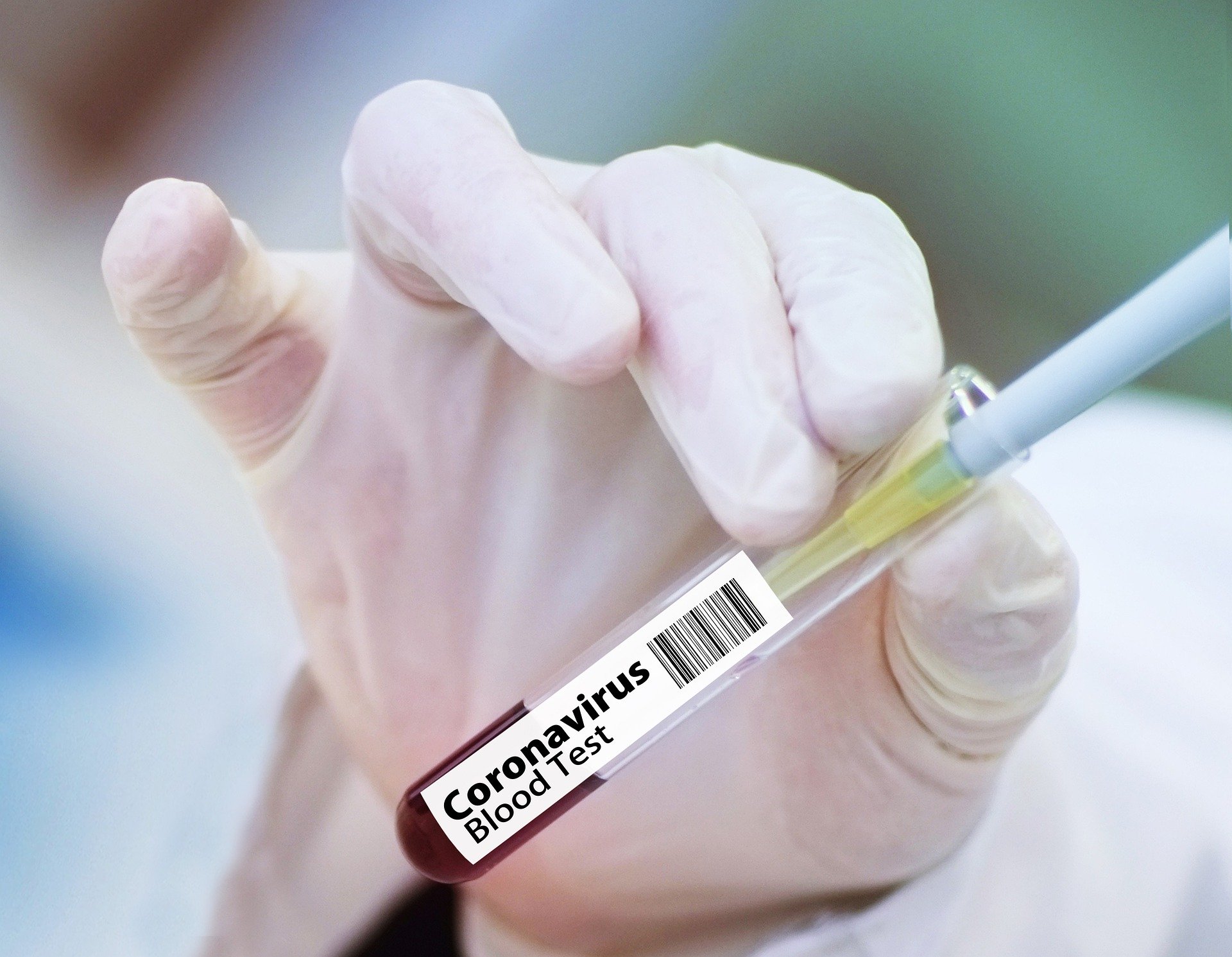 coronavirus-covid-korona-zaraza-test-kovid_5