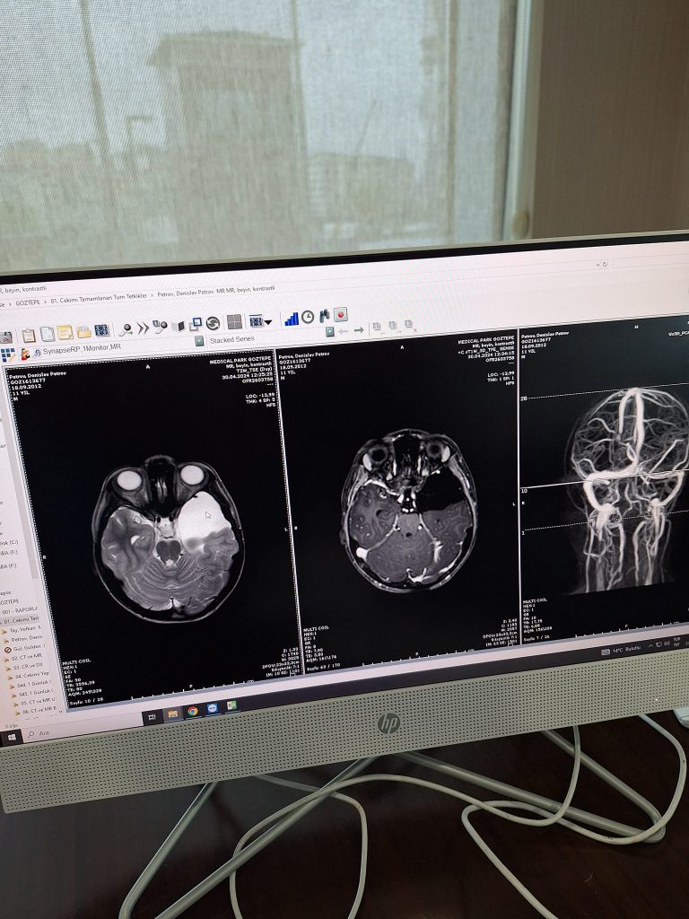 Родители чакат Великденско  чудо да спаси сина им