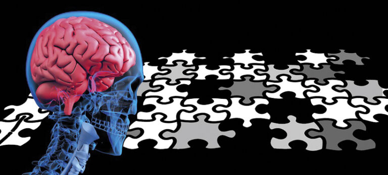 Д-р Николай Мойнов казва има ли превенция за болестта на Алцхаймер